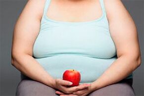 Norėdami išgydyti venų varikozę, turite atsikratyti antsvorio